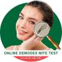 Suffer from Demodex mites infestation?