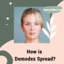 How is Demodex Spread? 🤔🔬