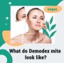 What do demodex mite look like?
