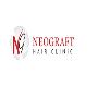 Female Hair Transplant in Chandigarh