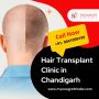 Hair Transplant Clinic in Chandigarh - NeoGraft India