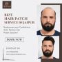 Best Hair Patch Service in Jaipur