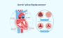 Aortic Valve Repair in India for Advanced Heart Treatment