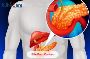 Best Bile Duct Cancer Treatment in India at Affordable Cost