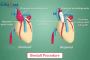 Affordable Bentall Procedure in India – Safe & Advanced Hear