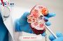 Affordable Blastocyst Transfer in India with High Success Ra