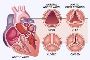 Top-Quality Aortic Stenosis Treatment in India – Expert Care