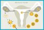 Transfert de blastocystes en Inde – Traitement de fertilité 
