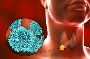 Traitement du cancer de la thyroïde en Inde avec EdhaCare