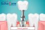 Affordable Dental Implant Treatment in India 