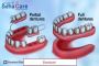Affordable Denture Treatment in India – Restore Your Smile w