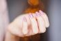 Niramaya Swasthyam: Gentle Care for Nail Psoriasis in Surat