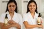 Have You Ever Tried Apricot Seed Oil for Skin? Have You Ever Tried Apricot Seed Oil for Skin?