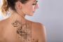 Professional Tattoo Removal – Sydney