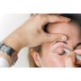 Eyelid Surgery Blepharoplasty Near Me