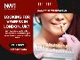 Thinking About Veneers In Uk London? 