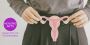 Effective Natural PCOS Treatments in NYC