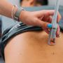Deep Tissue Laser Therapy in Orange County Deep Tissue Laser Therapy in Orange County
