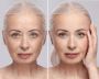 Face Lifting and Body Toning Services at St Catharines