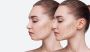 Chin Fillers Singapore – Sculpt a Refined V-Shape with Om Ae