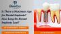 Is There a Maximum Age for Dental Implants? How Long Do Dent