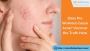 Does Pre Workout Cause Acne? Uncover the Truth Here