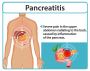 The Top 7 Ozempic Pancreatitis Symptoms You Need to Be Aware