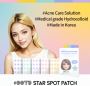 Pimple Star Patches – Acne Spot Care by #OOTD Beauty