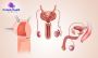 Circumcision Surgery Cost in Bangalore - Orchidz Health