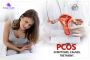 Best PCOS Treatment Cost in Bangalore