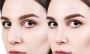 Best Rhinoplasty Doctor in Bhubaneswar 
