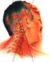Headaches & Migraines Diagnosis Services