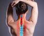 Cervical Radiculopathy Treatment In Orlando