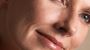 Lip Augmentation for Thin Lips in Newport Beach
