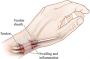 Wrist Pain Treatment