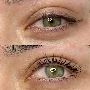 Searching for the best Microdermabrasion in Liverpool