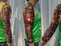 Best Tattoo Removal in Little India Best Tattoo Removal in Little India