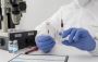 Blood Test Online with Free Sample Collection