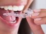 Top Dental Hygienist in Cardiff, Cathedral Road Dentist |