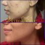 Embracing Timeless Beauty Naturally