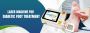 Laser Machine for Diabetic Foot Treatment – Phoxton