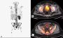 Book a PET Scan in Mumbai at Picture This Imaging 