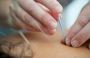 Acupuncture Therapy Center
