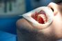 Stage 4 Mouth Cancer Treatment