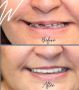 Document Your Smile with Before and After Pictures