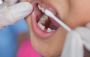Keep Cavities And Tooth Decay Away With Fluoride Varnish