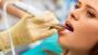Expert Mandibular Tori Removal in Chandler – Safe & Effectiv
