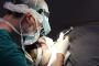 Men's Hair Transplant in Fort Lauderdale