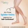 Where Can You Get Spider Vein Removal Treatments in Florida