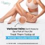What Is the Best Treatment for Varicose Veins? 